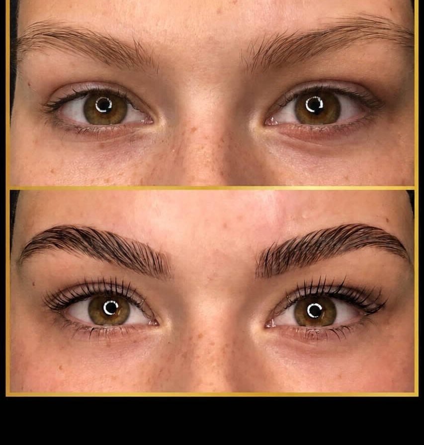 Korean Browlifting